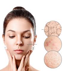skin cancer common types and