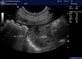 idiopathic gastric ulceration in dogs