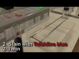 toludine blue stain you