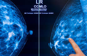 Controversy Surrounds New Mammogram Guidelines among Medical Professionals