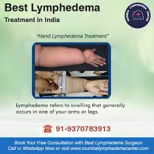 best lymphedema treatment in mumbai