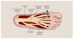 effective protocol for the management of plantar fasciitis