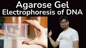 agarose gel electropsis of dna