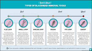 Blackhead Removal Tools Treatments The Ultimate Guide
