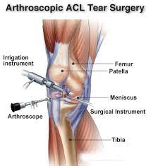 ligament injuries of the knee should