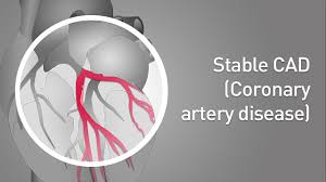le cad coronary artery disease