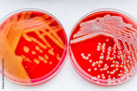 staphylococcus aureus and streptococcus