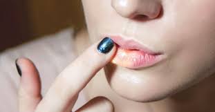 split lip treatment causes vitamin