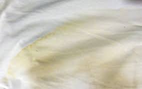 remove yellow stains from white shirts