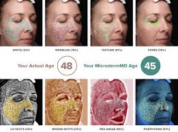 Trophy skin microderm md review and demo. Microdermmd Microdermabrasion Home Microdermabrasion Microdermabrasion Treatment