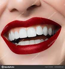 beautiful smile whitening teeth dental