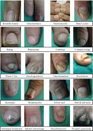 nail changes and disorders in elderly