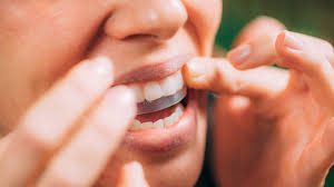 professional teeth whitening vs strips