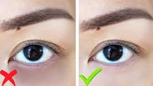 dark circles under your eyes without makeup