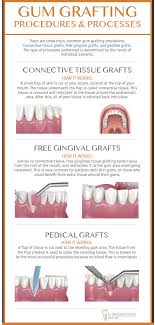 periodontal surgery plano tx gum