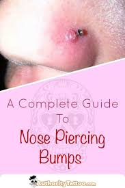Nose Piercing Bumps Are Very Common But Also Extremely