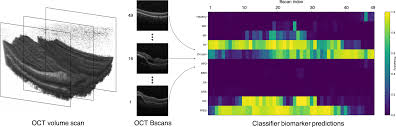 The ucat/ukcat abstract reasoning test is a very popular psychometric test used for medical and dental students/applicants. Expert Level Automated Biomarker Identification In Optical Coherence Tomography Scans Scientific Reports