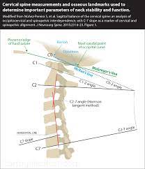 cervical lordosis from a car accident
