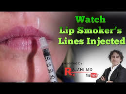 watch vertical lip smoker s lines
