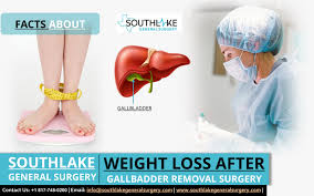 weight loss after gallbladder removal