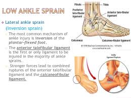 Image result for ankle sprain images public. This image identifies the ankle ligaments involved in a Low Ankle Sprain and illustrates the particular movement which results in the injury.