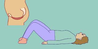 women get help with pelvic floor exercises