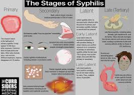 It results in a heterogeneous spectrum of disease with many systems that can potentially be. What Are The Three Stages Of Syphilis