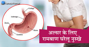 home remes for stomach ulcers प ट