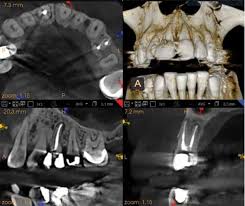 invest in the right cbct solution for
