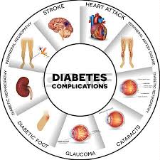 Image result for Diabete