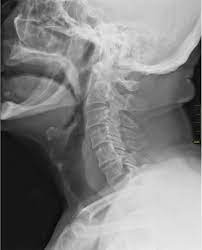 Файл:Medical X-Ray imaging EJE04 nevit.jpg — Википедия