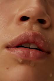 how to get rid of chapped lips lëkura