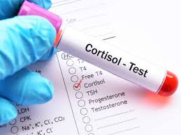 Cortisol Level Test Purpose Procedure And Results
