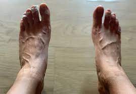 Jessica Henwick- damaged feet : r/famousfemalefeet