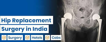 hip replacement surgery in india