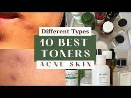 10 best acne toners i have used for