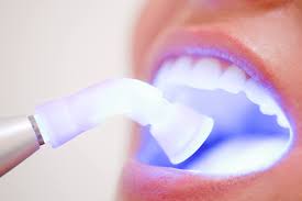 o clareamento dental
