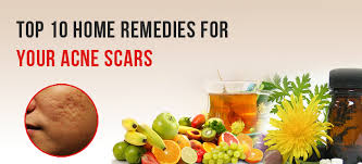 top 10 home remes for acne scars