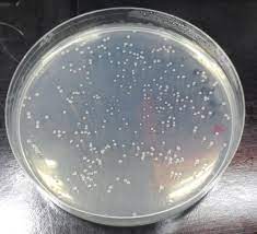 the agar plates grown with e coli