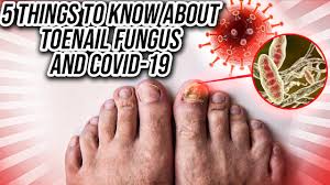 toenail fungus and covid 19