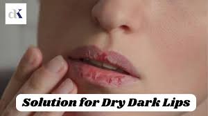 dry dark lips with best dermatologist