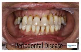 your ultimate guide to periodontal