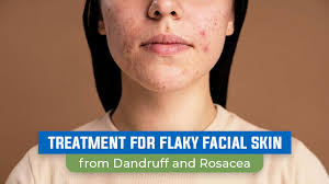 treatment for flaky skin from
