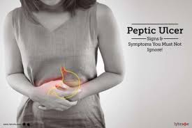 peptic ulcer signs symptoms you