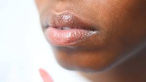 how to get rid of darkness around lips