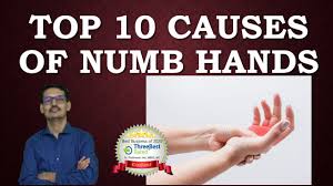 top 10 causes of numbness in hand you