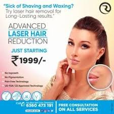 upper lip hair removal treatment with