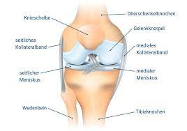 So kann etwa ein sogenanntes läuferknie vorliegen: Knieschmerzen Ursachen Symptome Behandlung