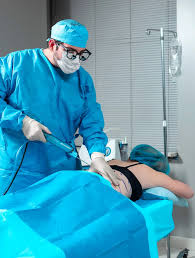laser liposuction laser lipo by dr
