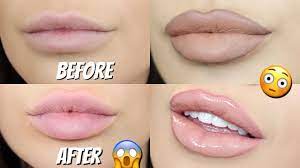 top 4 hacks for bigger lips naturally